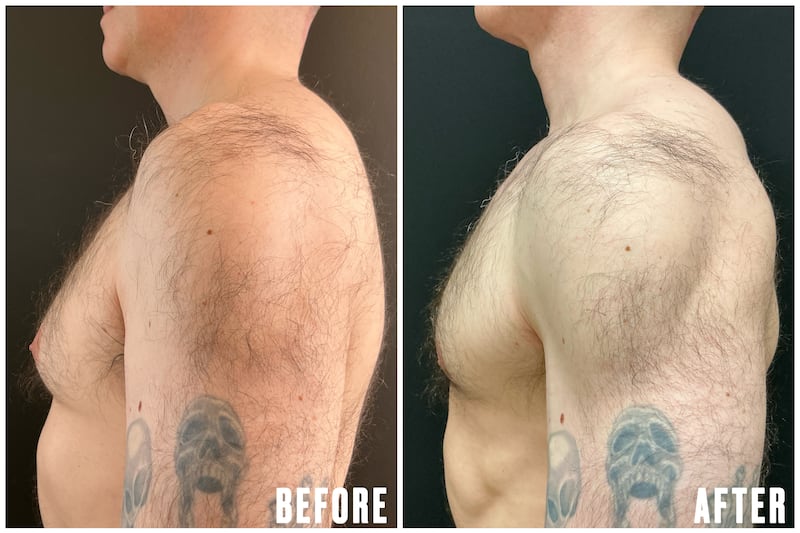 The Looker illo illustration for - This Plastic Surgery Gave Him The Confidence to Change Jobs