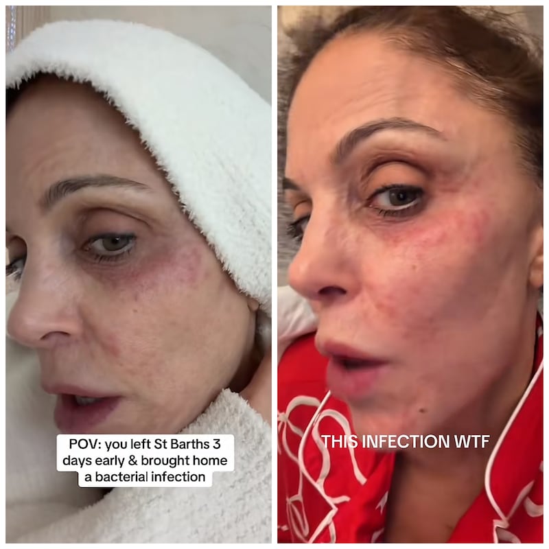 Bethenny Frankel