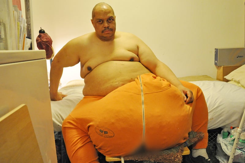 articles/2013/08/01/the-man-with-the-132-lb-scrotum-tlc-s-lowest-show-yet/130801-tlc-fallon-tease_aabtc3