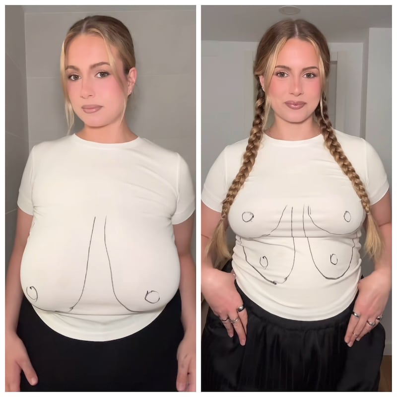 Ellen Larson is looking forward to wearing new kinds of tops after her surgery.
