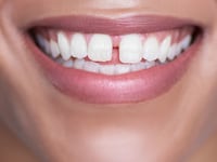 190809-Demopoulos-Teeth-tease_shhjjy