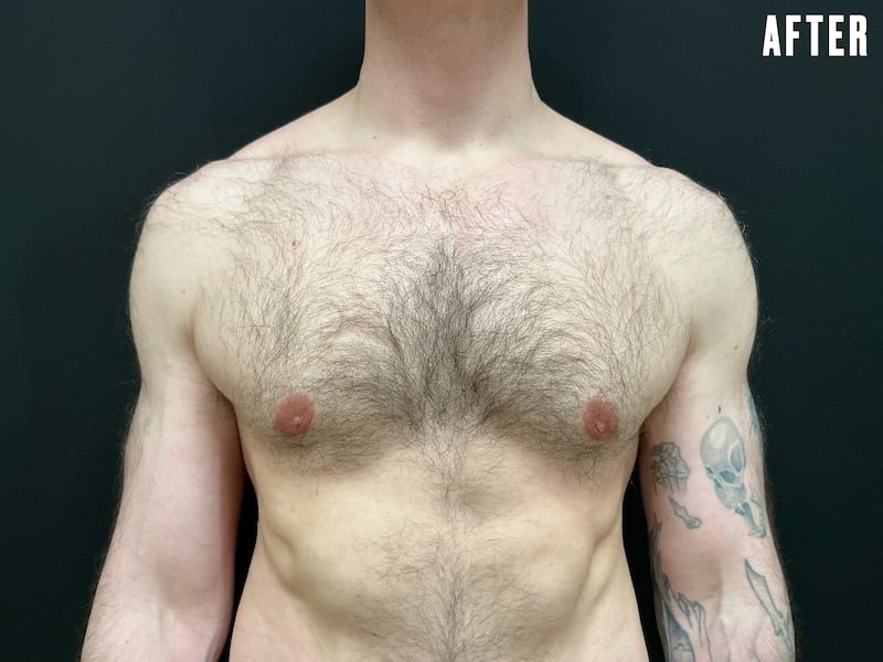 The Looker illo illustration for - This Plastic Surgery Gave Him The Confidence to Change Jobs
