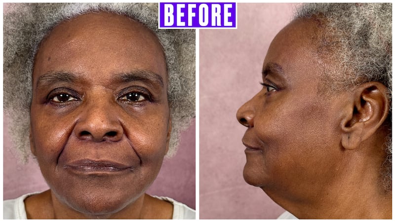 For The Looker - This Surgeon Gave His Mother a Facelift and the Results Went Viral