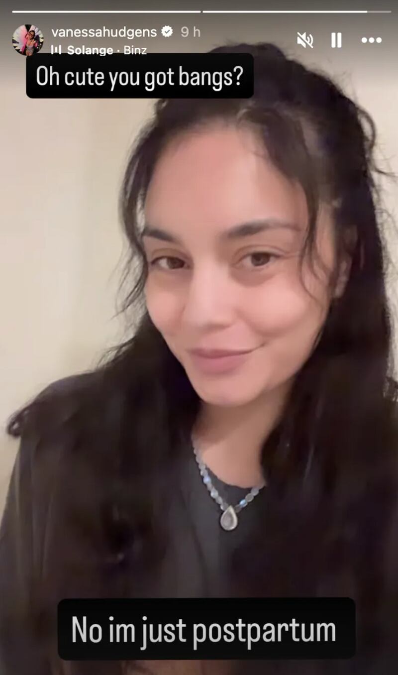 Vanessa Hudgens joked about her hair loss in an Instagram story.