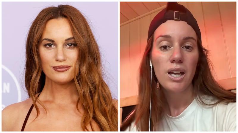 Hannah Berner "Donkey Smile" side effect of TMJ Botox