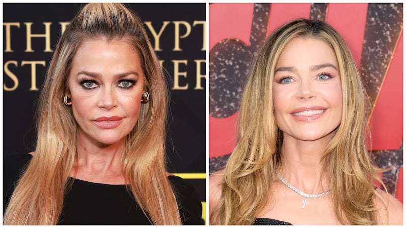 Denise Richards in April 2023 (left) vs. September 2025 (right). The actress underwent full facial rejuvenation in June 2025.