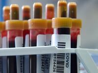 201014-axe-antibodies-tease_kndgyn
