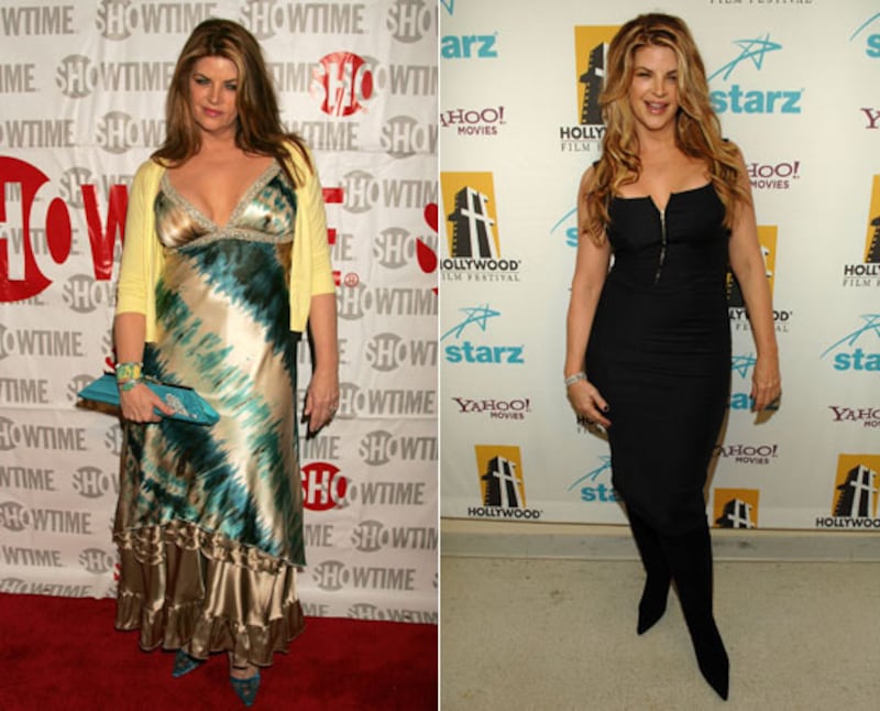 galleries/2010/01/09/celebrity-weight-loss/celebrity-weight-loss---kirstie-alley_mafgs0