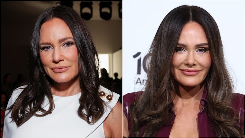 Marks underwent a facelift after noticing her face had started to look heavy.