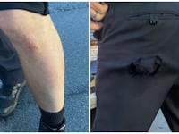Side-by-side photos of a scraped knee and ripped pants of a Louisville cop.