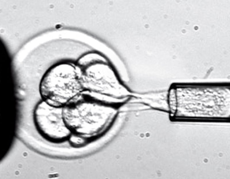 articles/2011/05/16/embryonic-stem-cell-therapy-are-we-on-the-brink-of-results/begley-stem-cells_180575_nahnqh