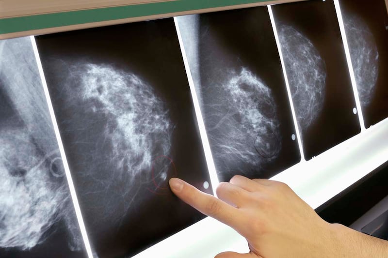 articles/2012/09/24/5-highlights-of-the-new-breast-cancer-study/breast-cancer-study-crocker_zohrne