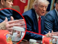 Donald Trump's bruised hand.