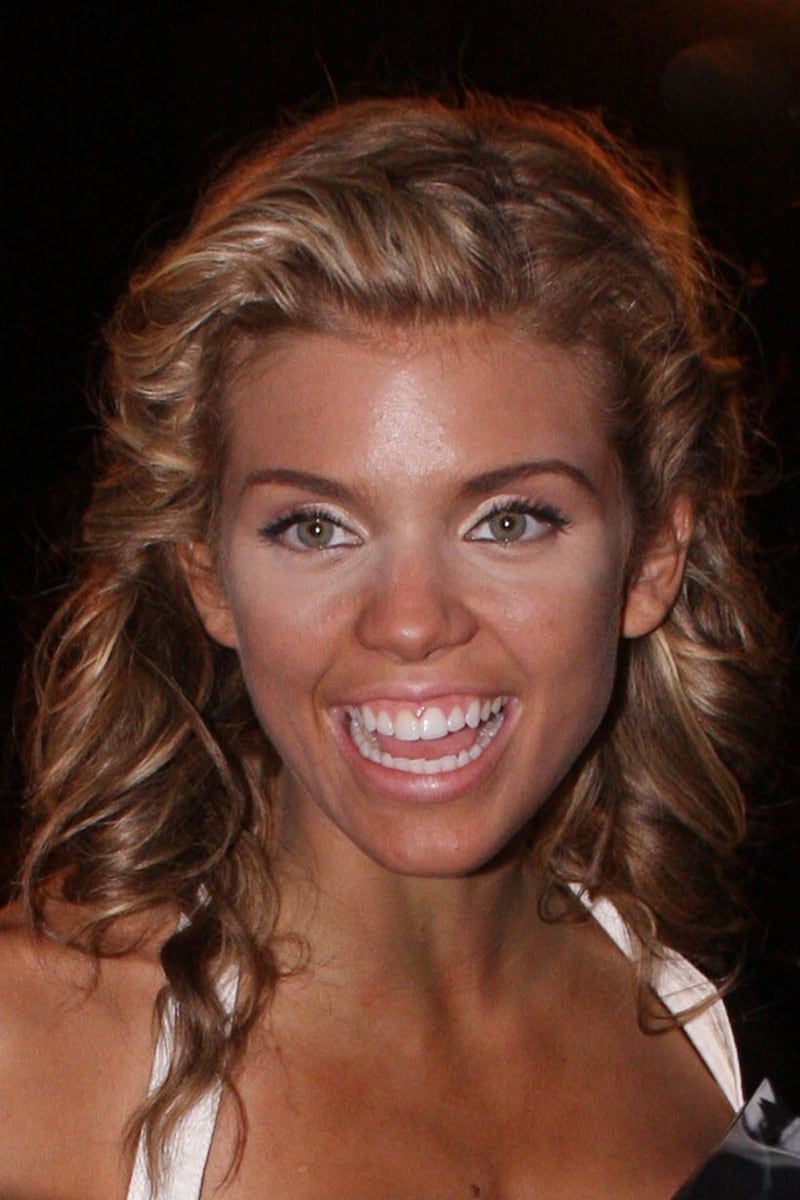 galleries/2011/07/04/celebrity-sunburns-kim-kardashian-simon-cowell-and-more/mccord-worst-celebrity-sunburns_apohfl