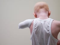2019-08-14T172659Z_1_LYNXNPEF7D1GB_RTROPTP_4_USA-TANZANIA-ALBINISM_gorf7l