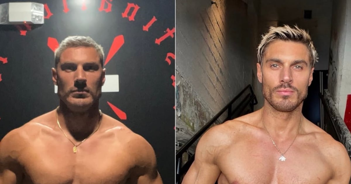 Reality Contestant Shares Shocking 2-Week Weight Loss Photos