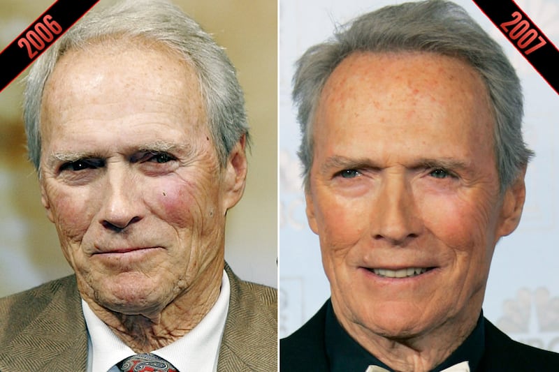 galleries/2011/10/05/simon-cowell-steve-martin-male-stars-rumored-plastic-surgery-photos/plastic-surgery-clint-eastwood-2_ckwivg