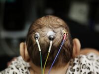 articles/2016/06/02/zika-s-arrived-america-needs-to-quit-yawning-and-pay-attention-to-women-s-health/160602-Karkowsky-zika-us-tease_o7n7mv