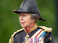 Princess Anne has been hospitalized with minor injuries and concussion, Buckingham Palace said.