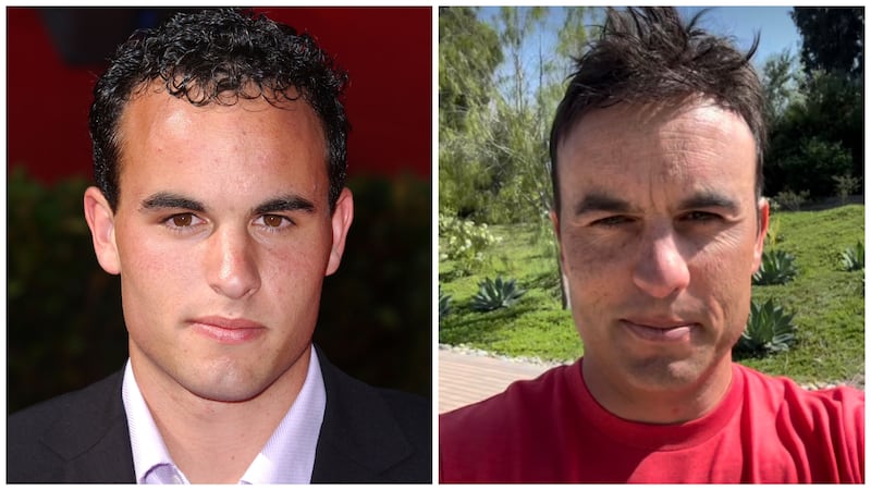 Landon Donovan in 2002 (L) and after his hairpiece installation in 2025