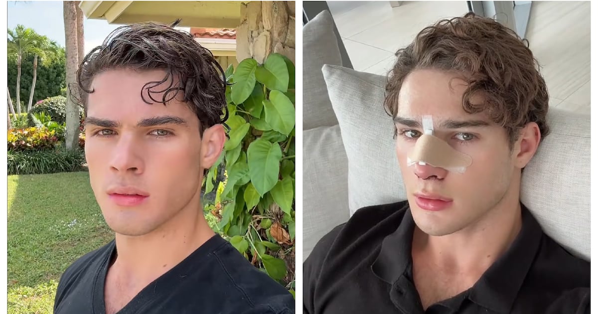 Manosphere Clown’s Plastic Surgery Reveal Draws Brutal Backlash