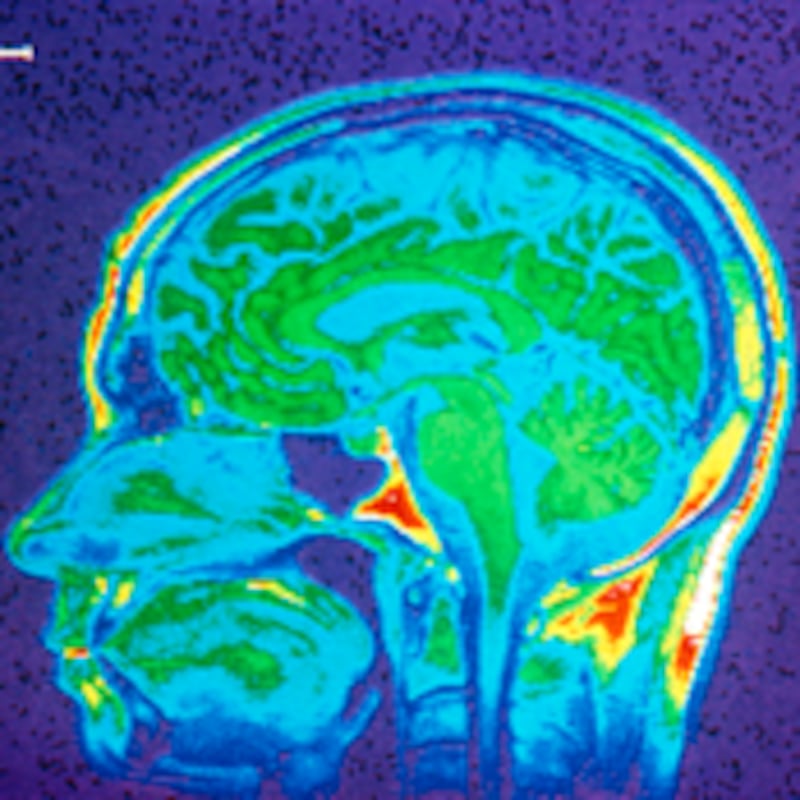 articles/2009/12/10/illustrating-the-brain/schwartz-mri-brain-technology_68747_eoei6d
