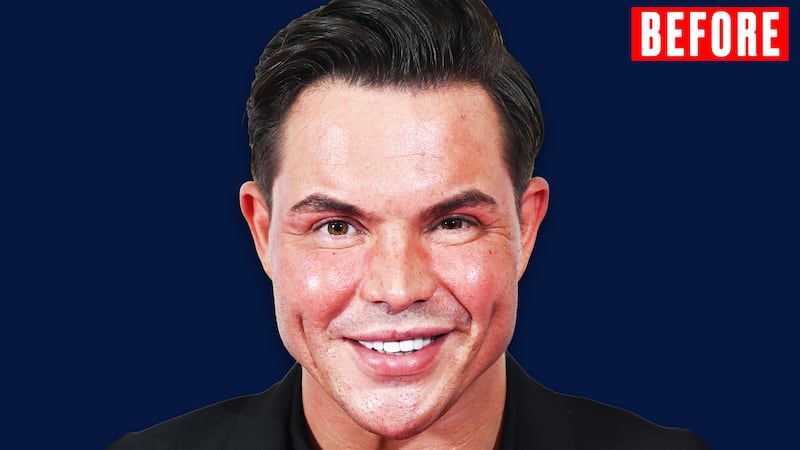 Bobby Norris for the Looker - Before.
