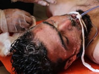 articles/2017/04/04/days-after-tillerson-mouths-russian-line-on-syria-assad-uses-gas/170404-weiss-gutman-dozier-syria-chem-attack-tease1_wxrokc
