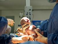 articles/2016/12/07/actually-there-s-no-way-to-know-if-c-sections-are-changing-humanity/161206-zadrozny-caesarean-births-tease_hhalru