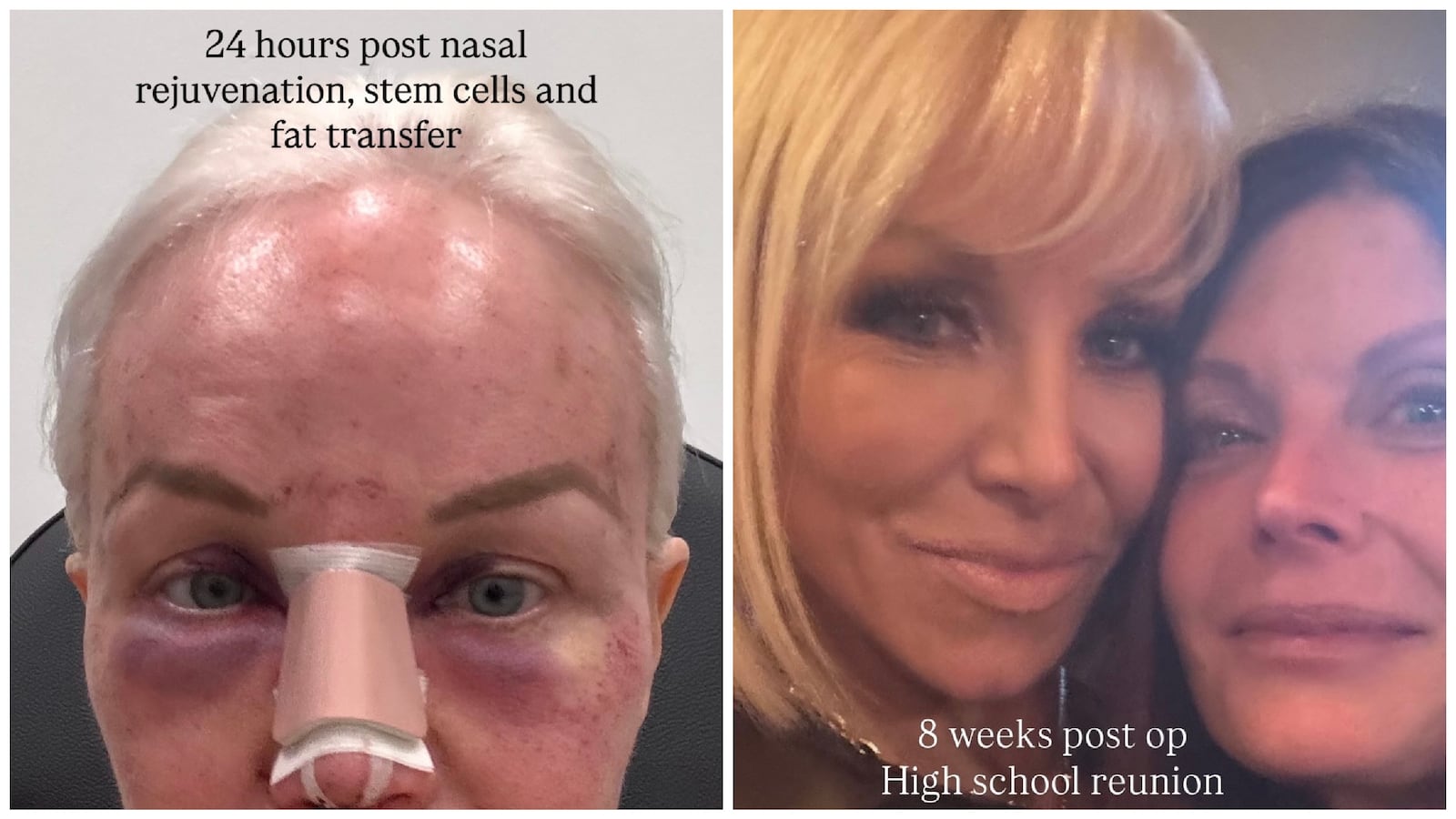 Plastic surgery Margaret Josephs