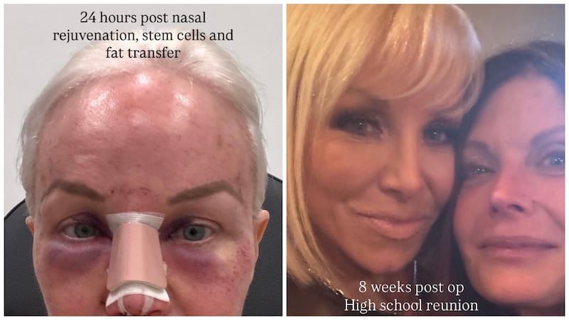 Plastic surgery Margaret Josephs